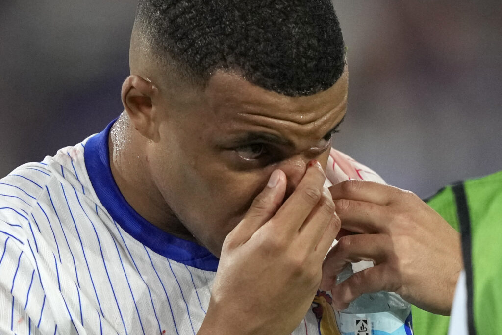 Kylian Mbappe of France holds his nose after suffering an injury during a Group D match between Austria and France at the Euro 2024 soccer tournament in Duesseldorf, Germany, Monday, June 17, 2024. (AP Photo/Martin Meissner)