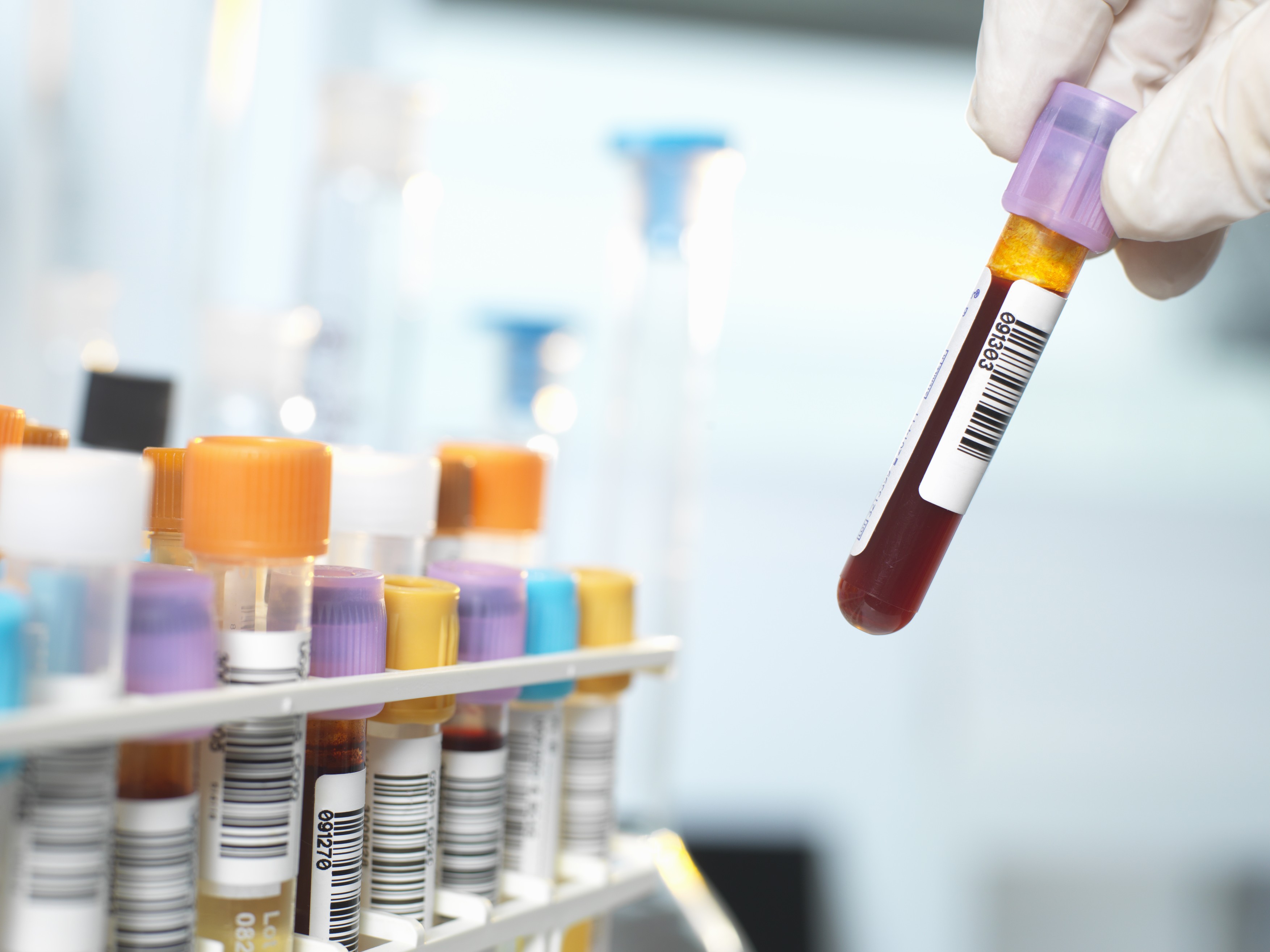 Laboratory technician preparing blood sample for medical testing in laboratory