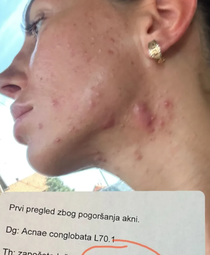 Printskrin Instagram/aleksandracipka