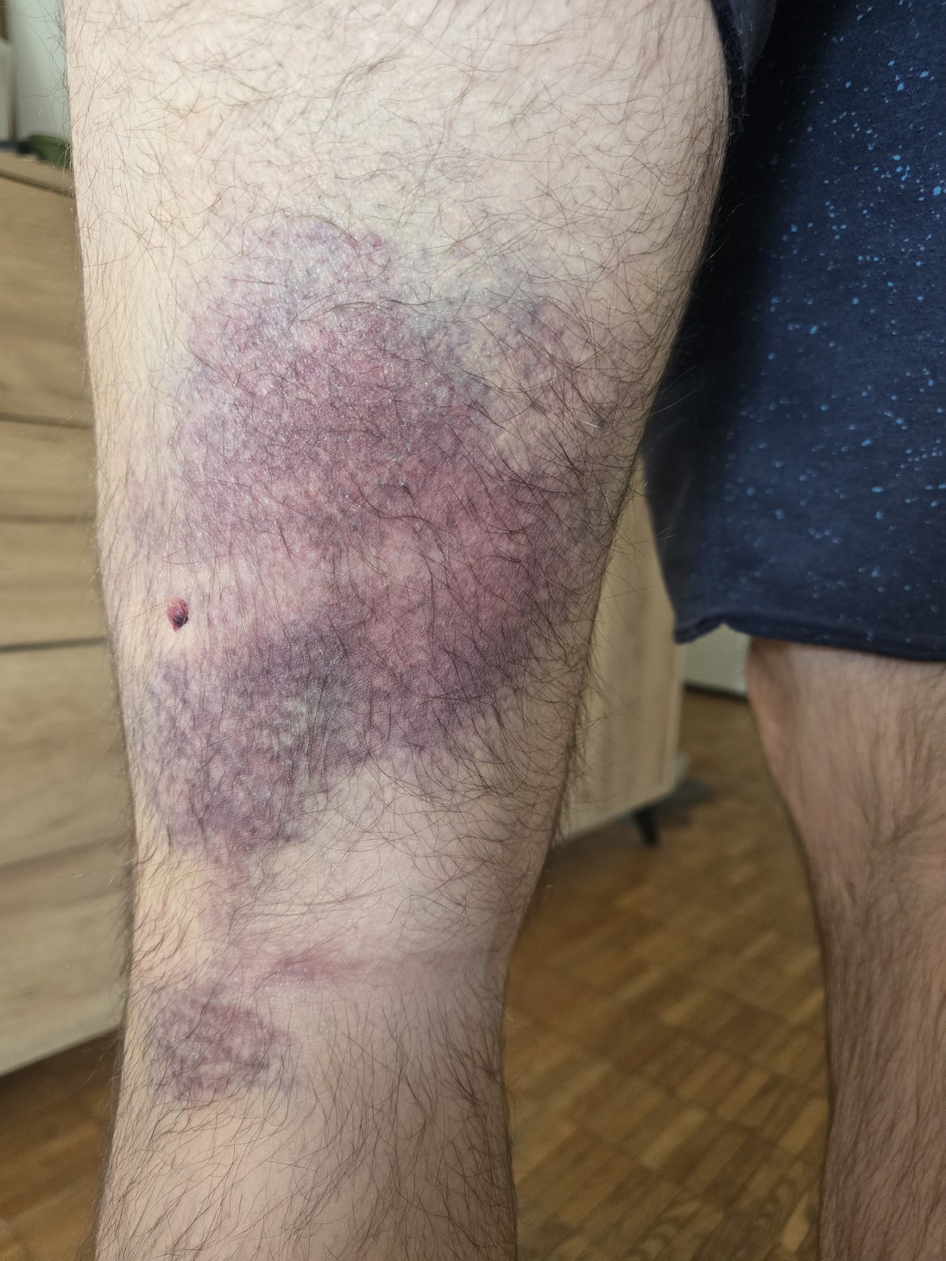 Pretucen mladić od ćacija u Bg (3).jpeg