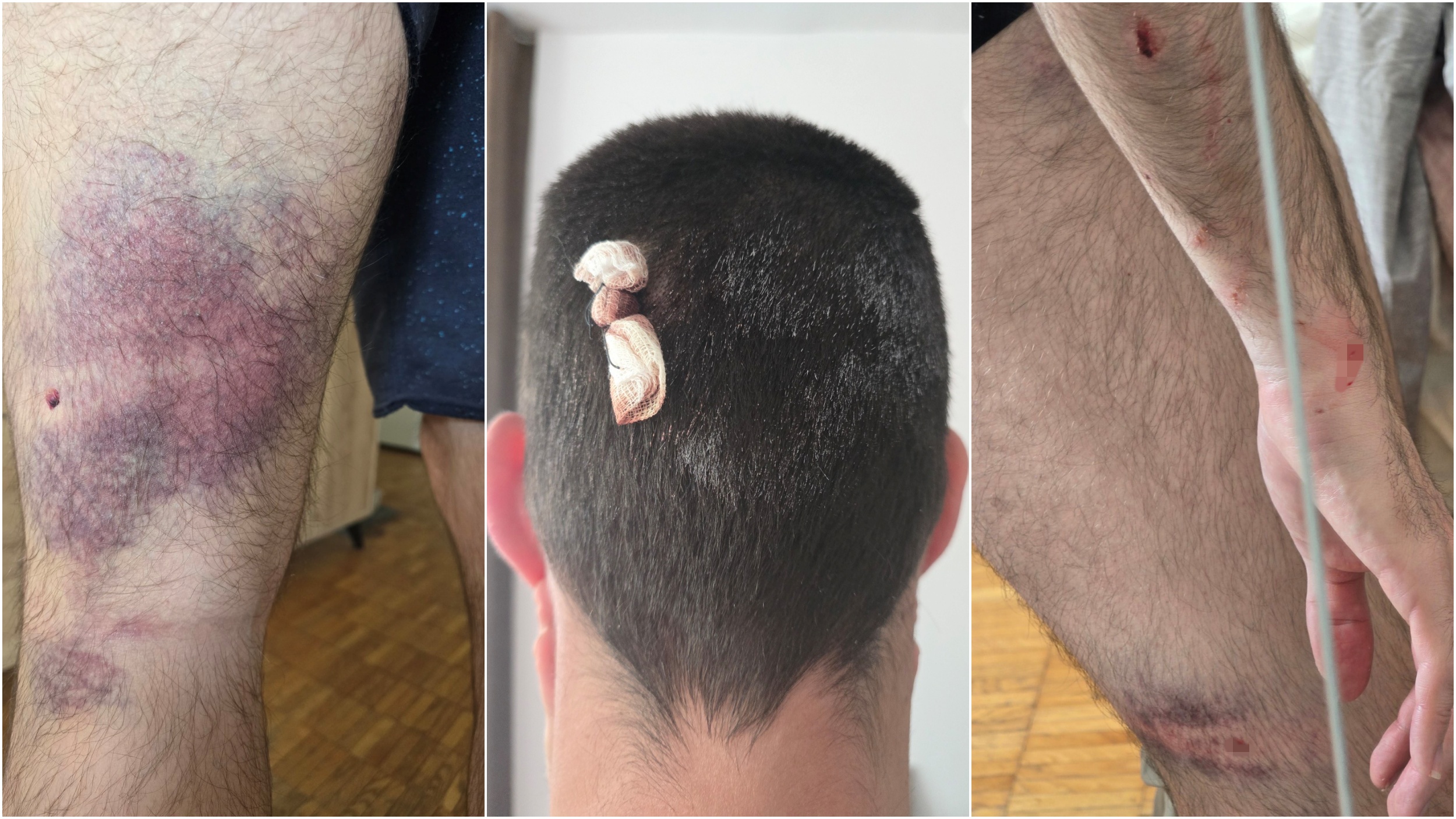 pretučen mladić Pretucen mladić od ćacija u Bg.jpg