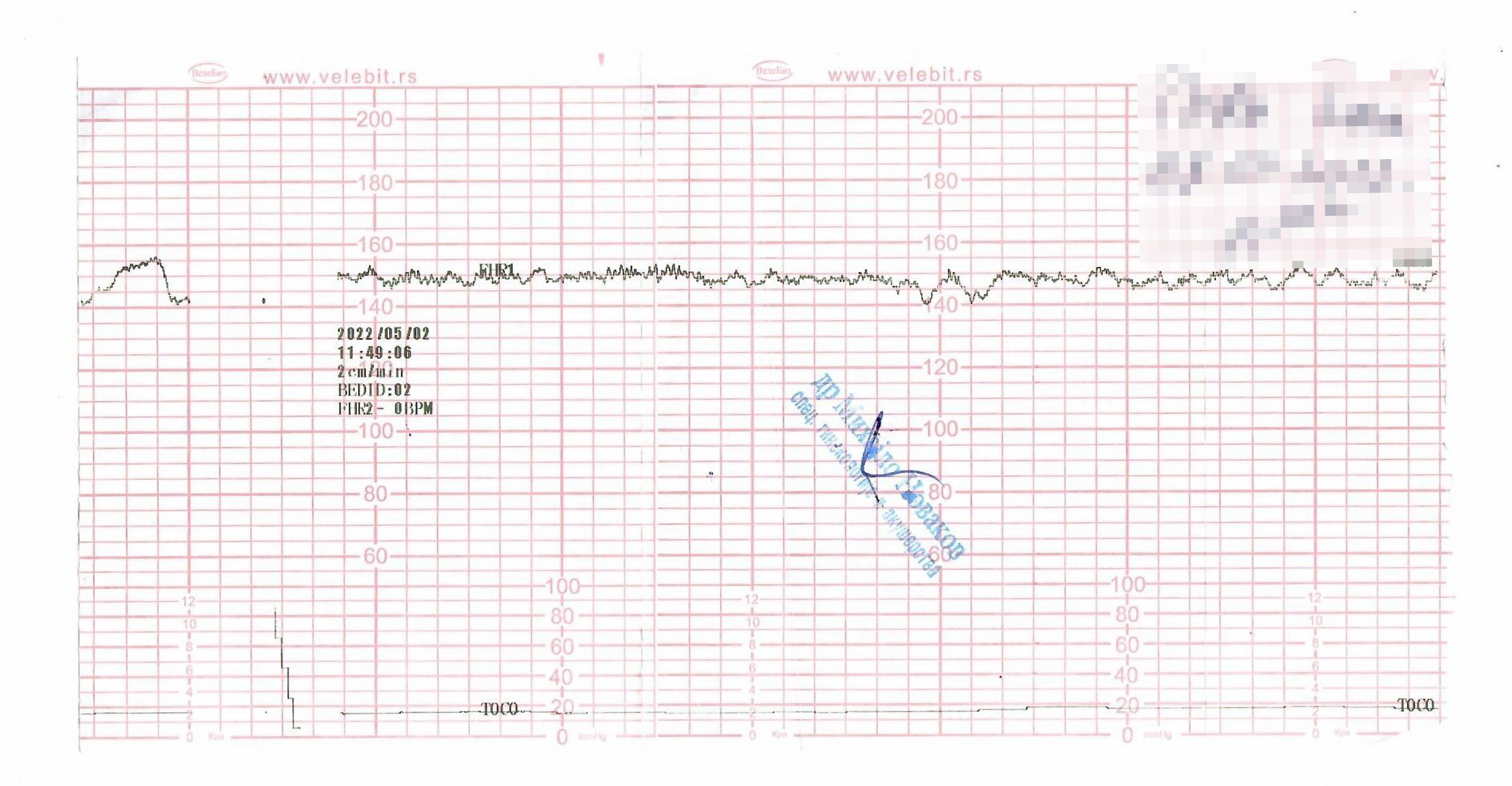 ctg foto privatna arhiva.jpg