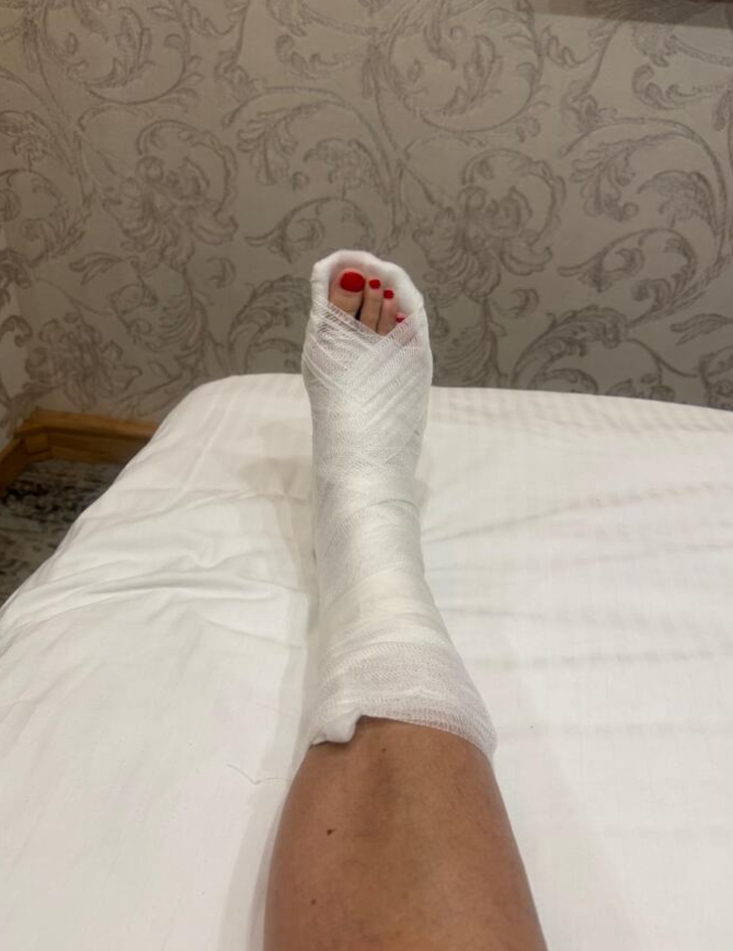 goga sekulić gips