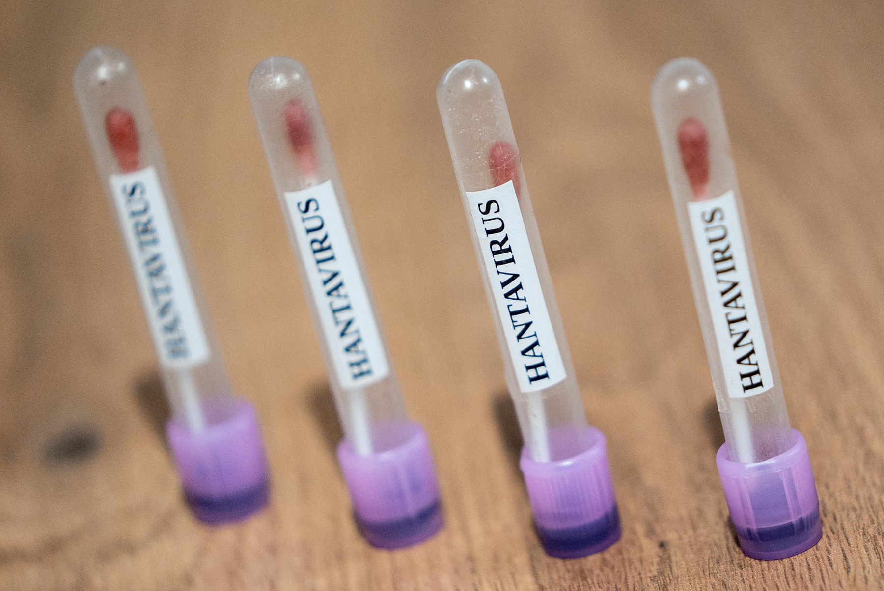 Hantavirus profimedia-1097044881.jpg