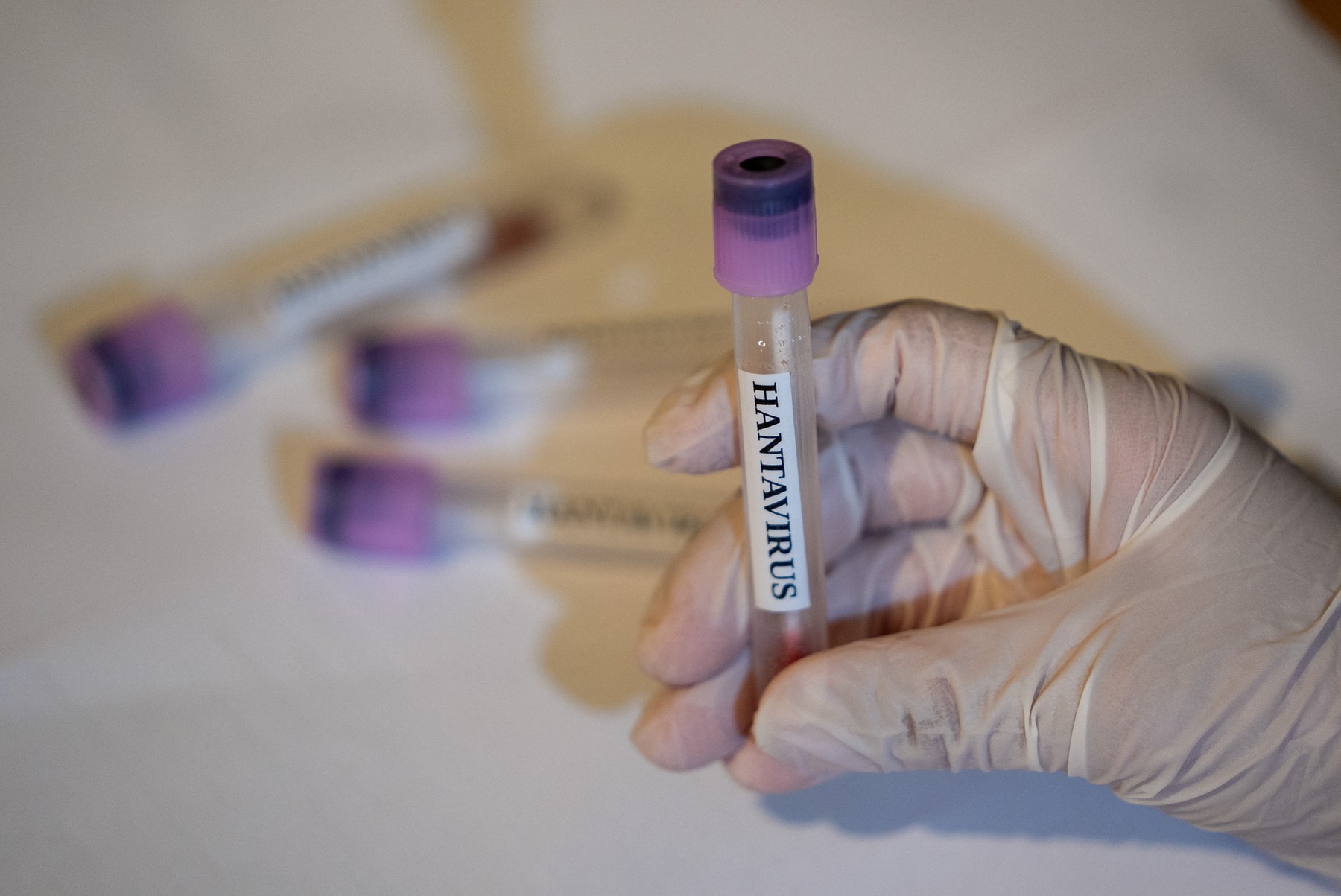 Hantavirus profimedia-1097044813.jpg
