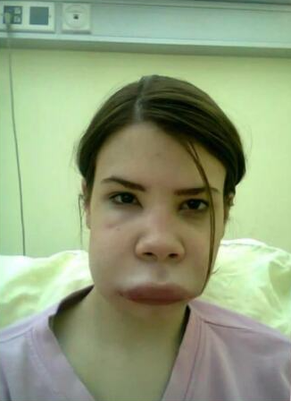 Jovana Cvetković jovana usta.png