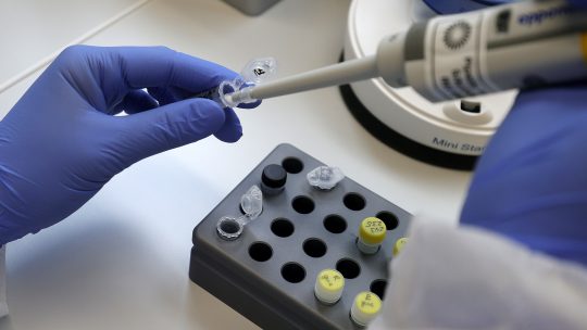 Testiranje uzoraka na koronavirus u laboratoriji