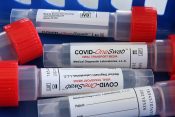 test na koronavirus