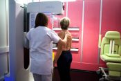 mamografski pregled; mamograf