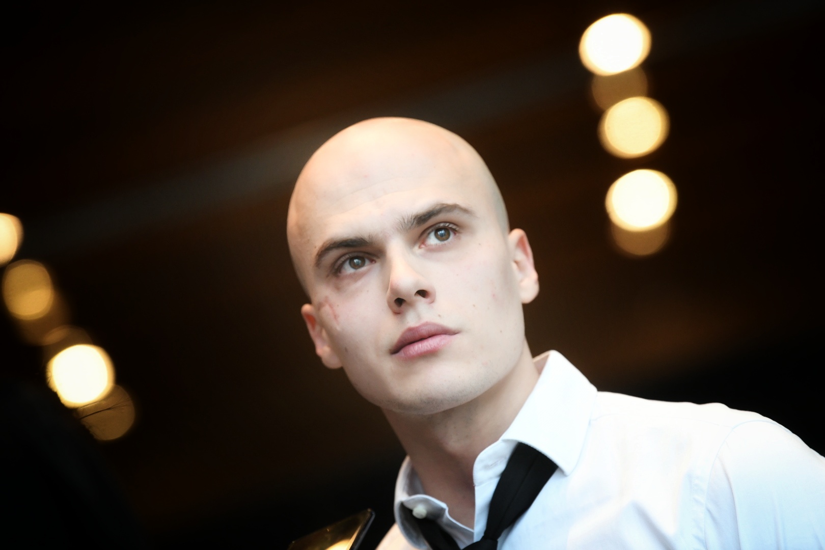 "Usledile su operacije i na kraju mi je ostao zaštitni znak" Srpski