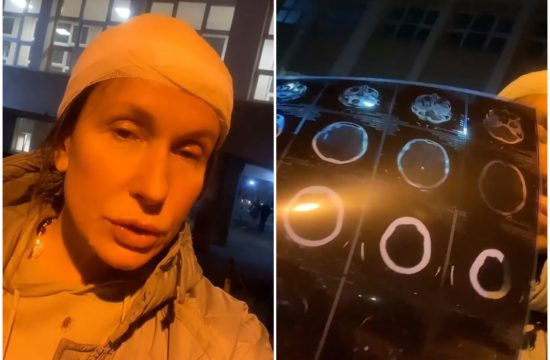 Snežana Dakić, povređena, povredjena, povreda glave, gađali, gadjali je kamenom u glavu, urgentni centar