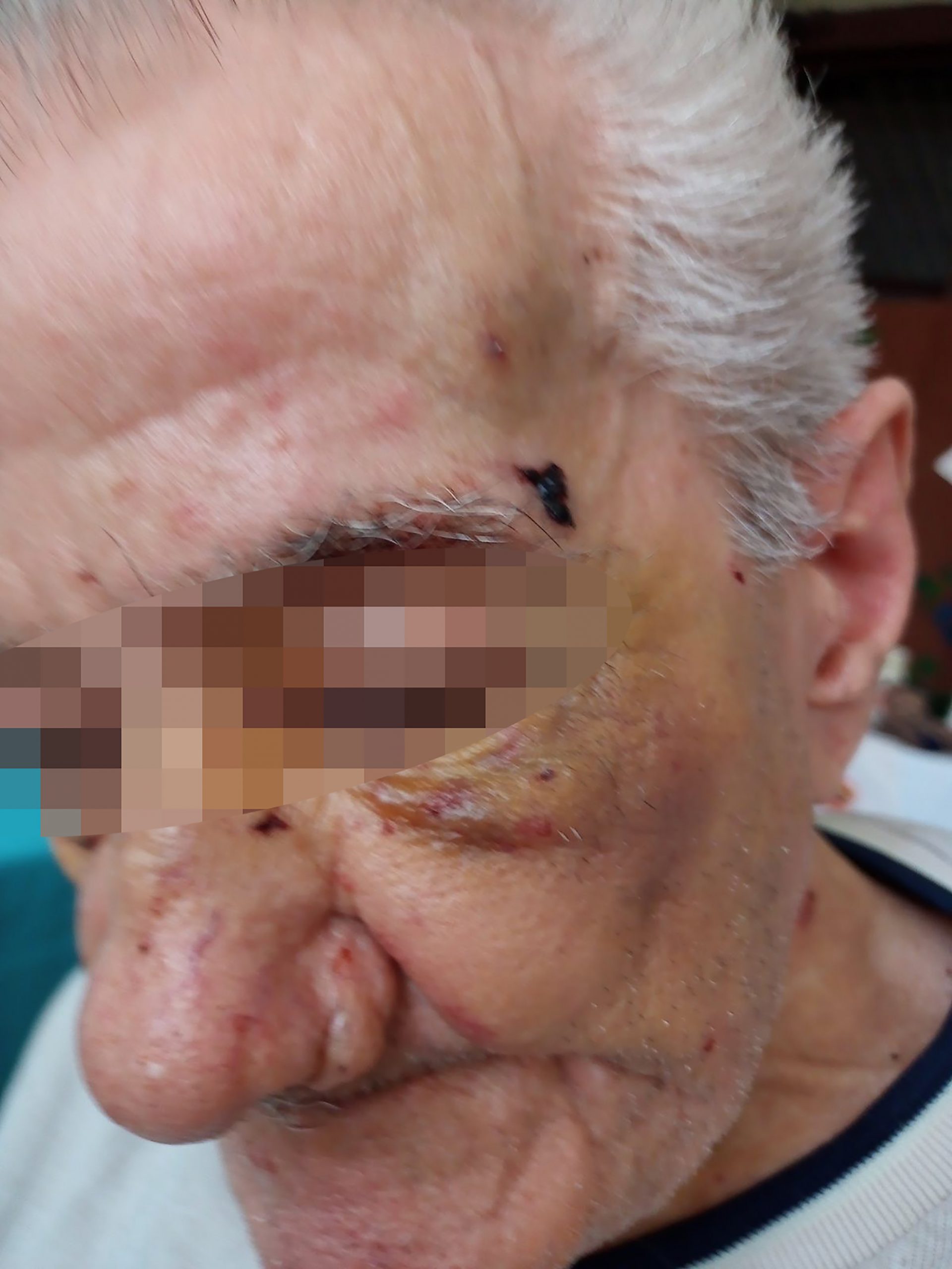 Obrenovac 02.06.2022. pretučeni starac u gernotoloskom centru u obrenovcu