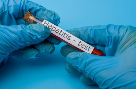 hepatitis