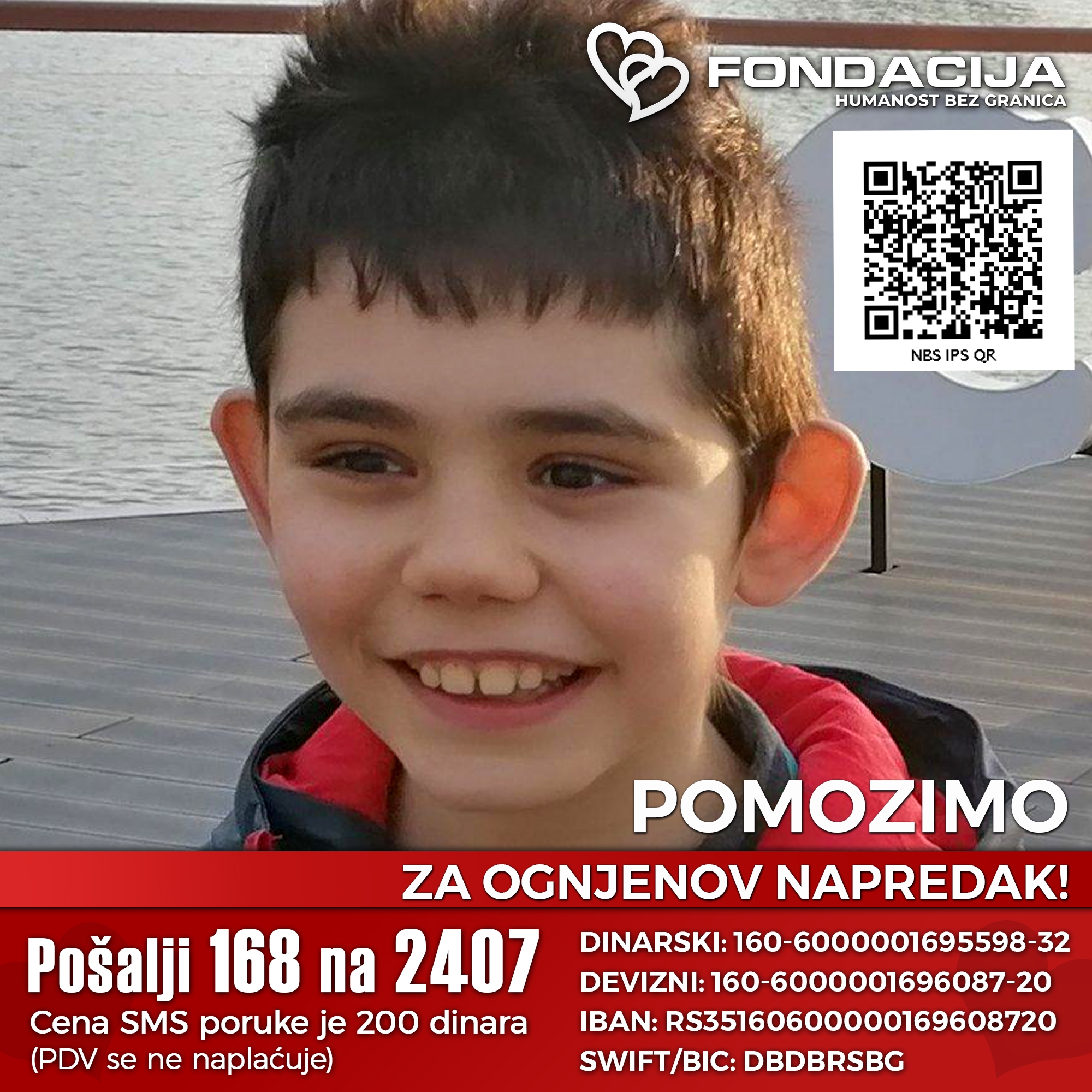 Ognjen je bio potpuno zdrav dečak sve do drugog rođendana Onda su