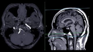 Snimak mozga - ilustracija