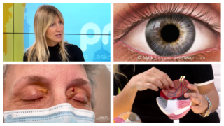 Dr Katarina Bajec o očima kao ogledalu zdravlja: Problemi sa srcem se vide i u vašem oku