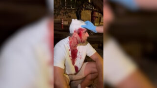 Peđa Mitrović krvave glave na protestu