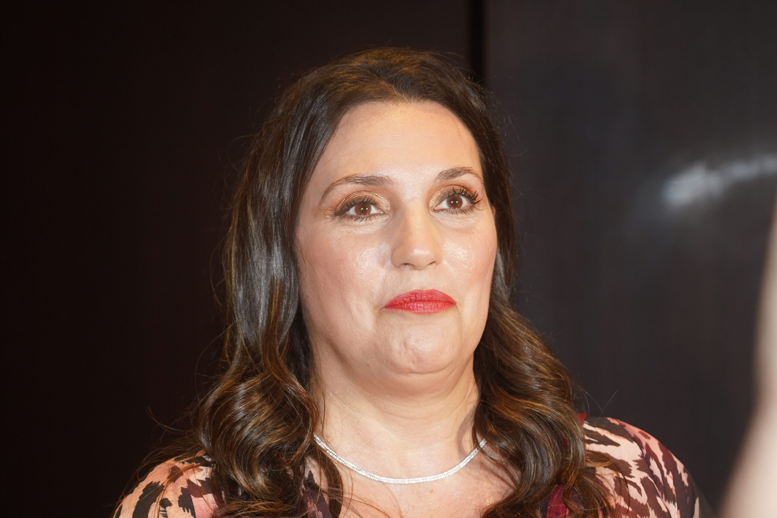 Glumica Milica Milša otkrila da joj je dijagnostikovan rak: "Juče sam imala dve operacije"