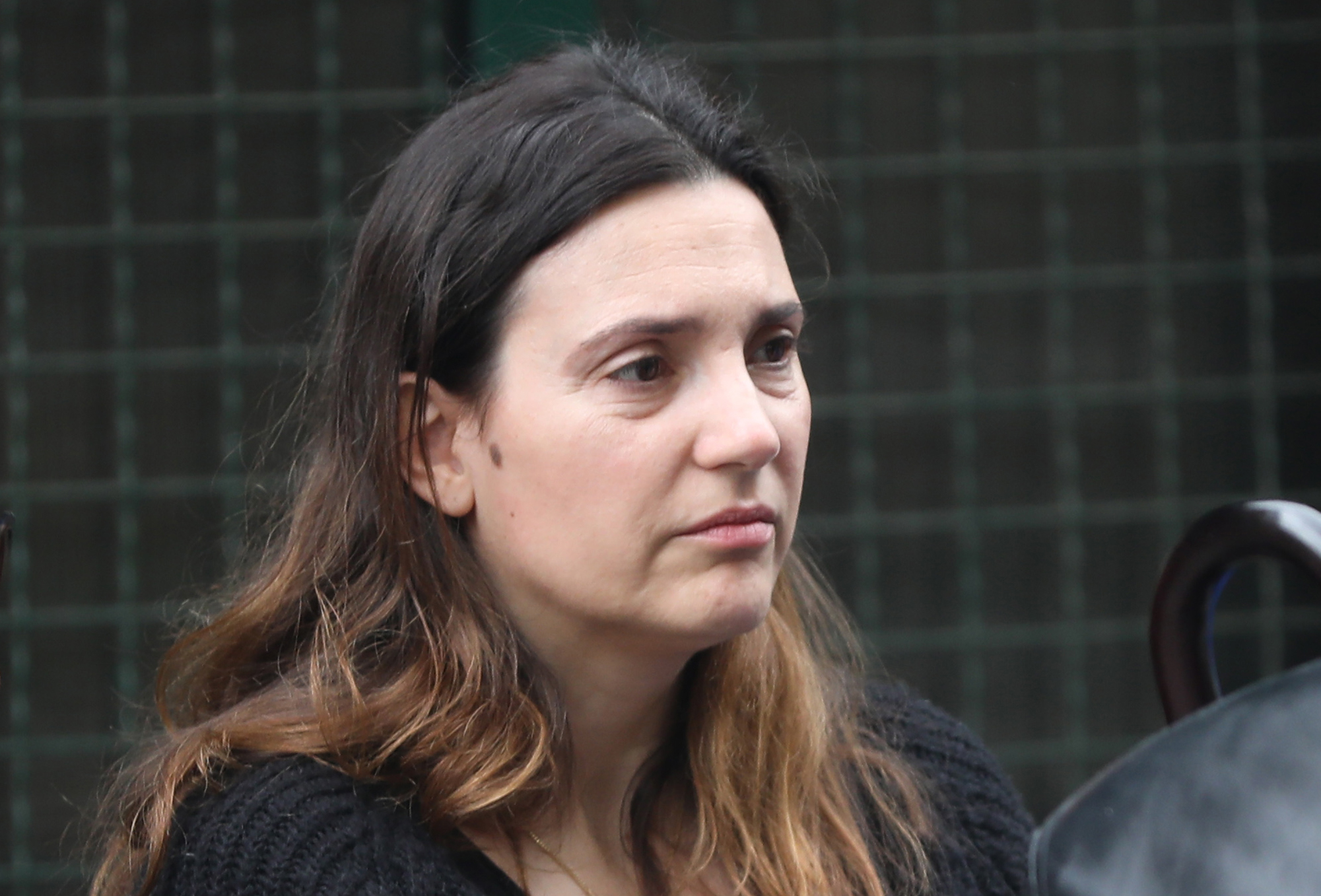 "Posle operacije nisam mogla da podignem ruke": Milica Milša otkrila šta je glavni uzročnik basocelularnog raka kože